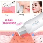 ⁦Pack de Beauté Appareil Ultrasonic purificateur points noir et Rasoir Electrique 4en1⁩ - الصورة ⁦2⁩