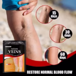 ⁦Patchs Herbales Anti-Varices Soulagement Douleur, Amélioration Circulation 12Pcs - لاصقات الأعشاب الطبيعية لعلاج الدوالي والدورة الدموية⁩ - الصورة ⁦3⁩